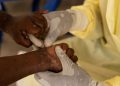 casos-de-mpox-no-brasil-este-ano-ja-superam-o-total-de-2023