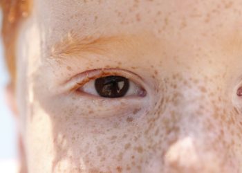 campanha-de-conscientizacao-sobre-retinoblastoma-comeca-hoje