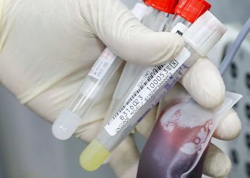 teste-rapido-na-deteccao-da-febre-bubonica-e-avaliado-em-campo