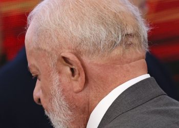 lula-vai-a-hospital-e-retira-pontos-de-corte-apos-queda