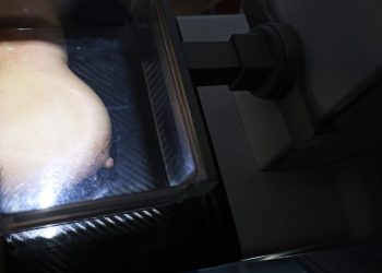 medicos-reafirmam-eficacia-da-mamografia-para-prevenir-cancer-de-mama
