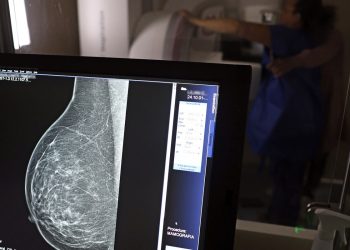 cerca-de-77-mil-mulheres-aguardam-mamografia-pelo-sus