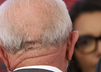 lula-faz-exames-em-brasilia-e-apresenta-quadro-estavel