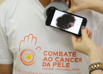 mutirao-atende-populacao-hoje,-no-dia-de-combate-ao-cancer-de-pele