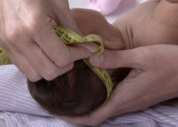 pessoas-com-deficiencia-associada-ao-zika-terao-pensao-vitalicia