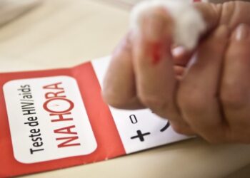 aids:-brasil-tem-alta-de-casos,-mas-menor-mortalidade-desde-2013
