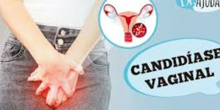 candidiase-vaginal:-o-que-e,-sintomas,-diagnostico,-tratamento-e-prevencao