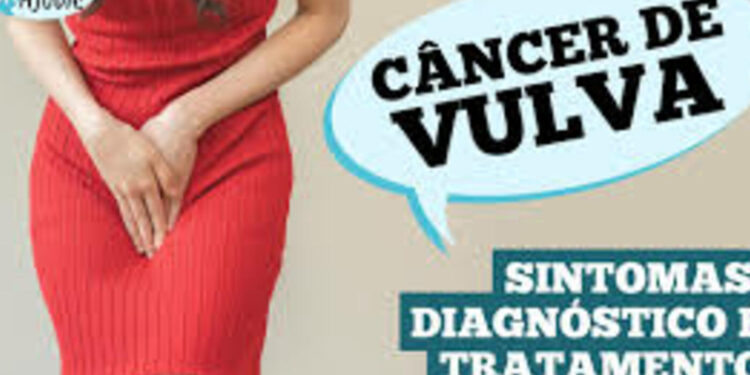 ja-ouviu-falar-de-cancer-de-vulva?-caroco,-coceira-e-feridas-podem-ser-sintomas