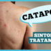 dr.-ajuda:-qual-a-relacao-da-catapora-com-o-herpes-zoster?