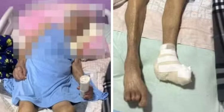 Enfermeira amputa pé de idosa de 103 anos sem anestesia no DF; caso é investigado
