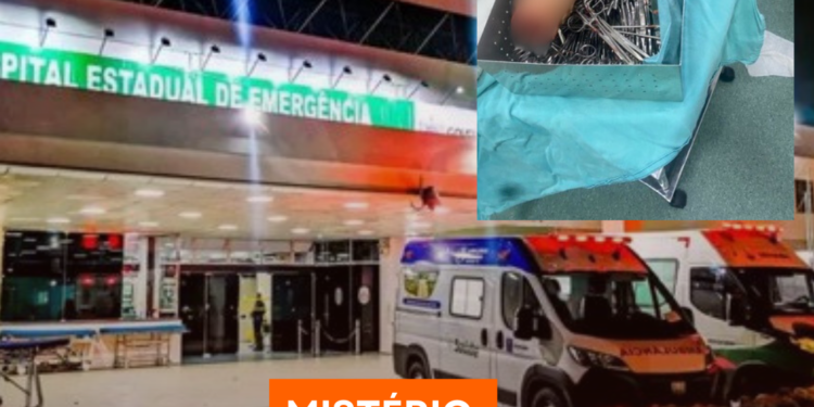 Idoso é hospitalizado com objeto de 1 metro no anus