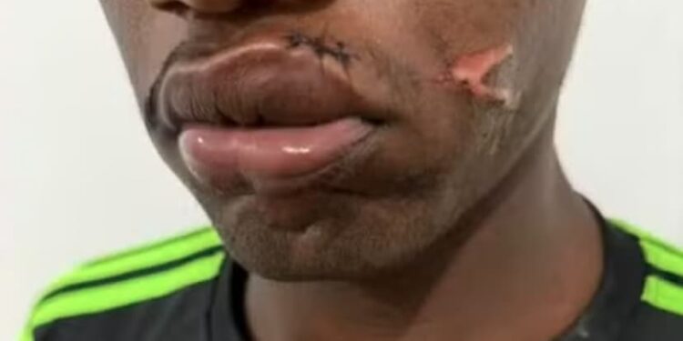 Mulher é presa após agredir companheiro com pá; crime ocorreu após vítima chegar tarde em casa