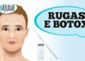 dr.-ajuda:-rugas-e-botox