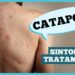 catapora:-sintomas,-complicacoes-e-prevencao