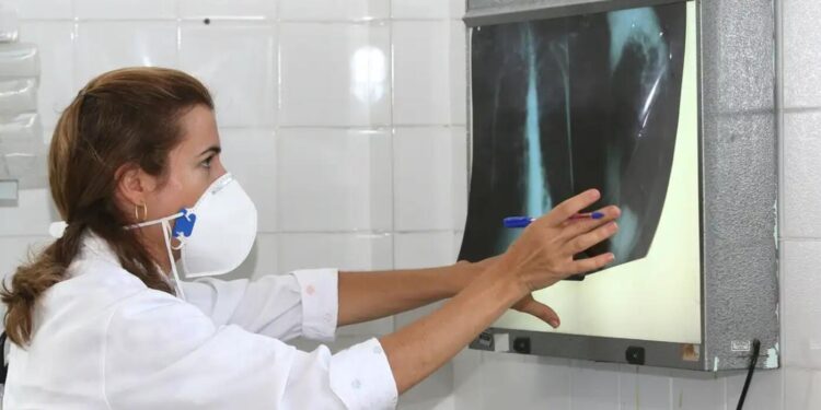 tuberculose:-amazonas-lidera-incidencia-no-brasil,-seguido-por-roraima-e-rio-de-janeiro