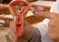 endometriose:-conheca-os-sintomas-e-saiba-como-tratar-a-doenca