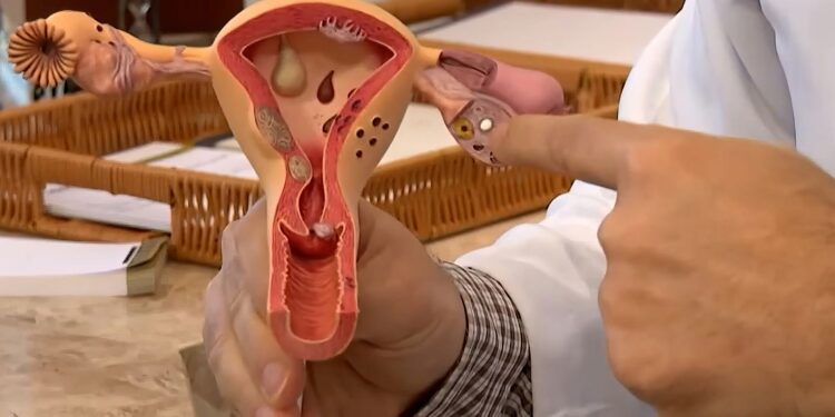 endometriose:-conheca-os-sintomas-e-saiba-como-tratar-a-doenca