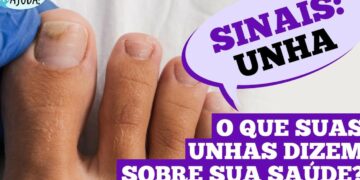 unhas-fracas-podem-indicar-problemas-de-saude