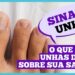 unhas-fracas-podem-indicar-problemas-de-saude