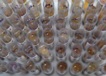 casos-de-malaria-no-brasil-caem-26%-no-primeiro-trimestre-de-2025