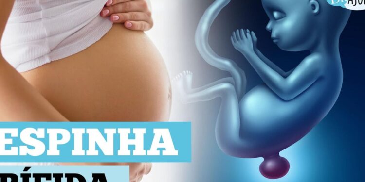 o-que-e-e-como-prevenir-a-mielomeningocele?