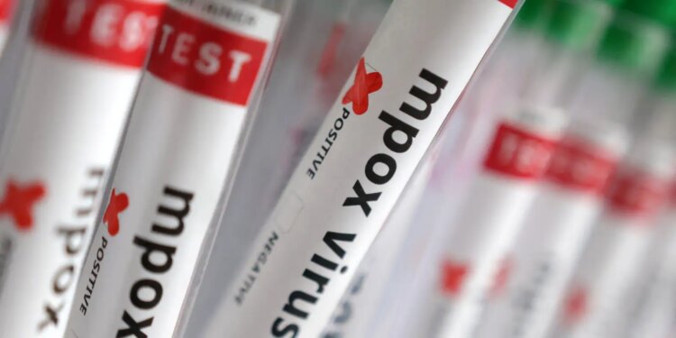 regiao-norte-do-brasil-registra-casos-de-mpox