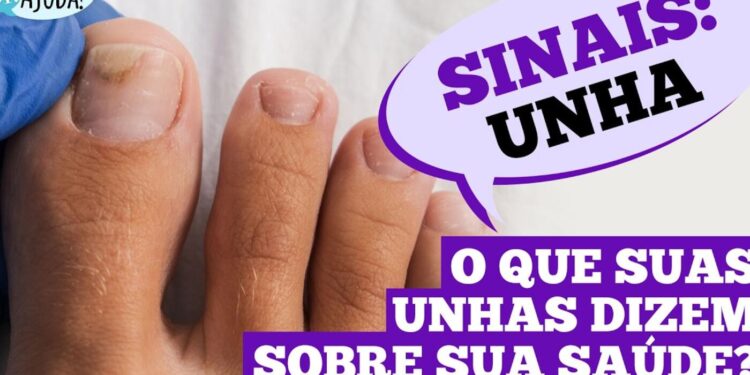 dr.-ajuda:-unhas-fracas-podem-indicar-problemas-de-saude