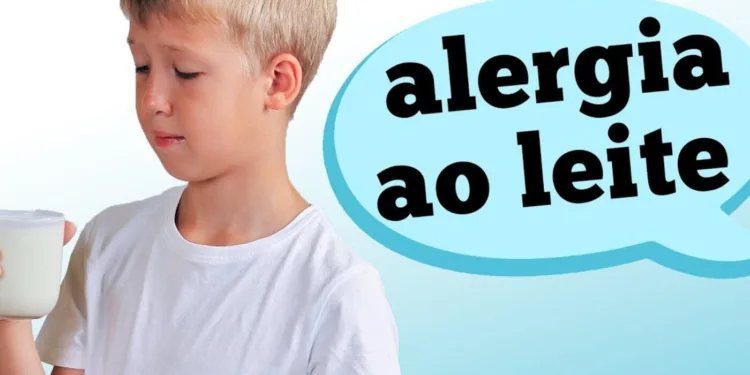 alergia-ao-leite-de-vaca-em-criancas
