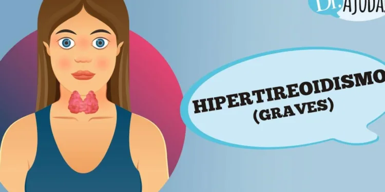 hipertireoidismo,-o-que-e?