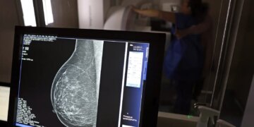 cancer-de-mama:-uma em-cada-tres pacientes tem-menos-de-50-anos