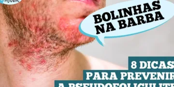 pseudofoliculite:-saiba-como-prevenir