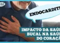 endocardite:-o-perigo-oculto-nos-seus-dentes