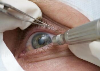 cirurgia-que-altera-cor-do-olho-tem-uso-restrito-para-pessoas-cegas