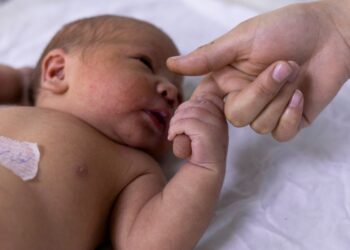 teste-do-olhinho-deve-ser-repetido-tres-vezes-ao-ano-ate-os-3-anos