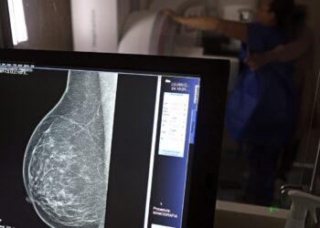 ministerio-da-saude-passa-a-recomendar-mamografia-a-partir-dos-40-anos