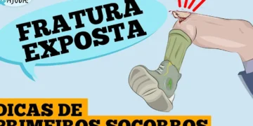 fratura-exposta:-dicas-de-primeiros-socorros