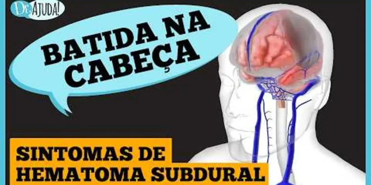 batida-na-cabeca:-sintomas-de-hemorragia-subdural