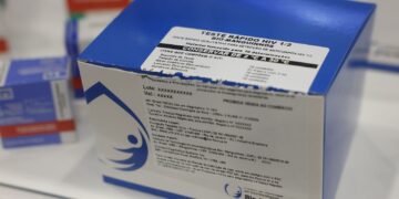 fiocruz-vai-ampliar-producao-de-kits-diagnosticos-para-o-sus