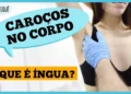 ingua-no-pescoco,-axila-ou-virilha?-entenda-o-que-pode-ser