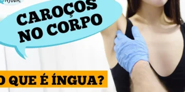 ingua-no-pescoco,-axila-ou-virilha?-entenda-o-que-pode-ser