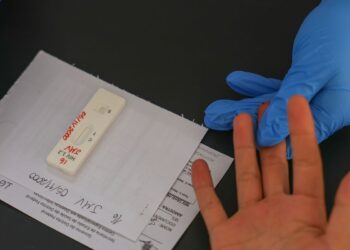 hiv/aids:-brasil-vai-insistir-em-acordo-por-prep-de-longa-duracao