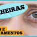 olheiras:-por-que-aparecem-e-o-que-fazer