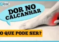 dor-no-calcanhar:-pode-nao-ser-o-que-voce-pensa