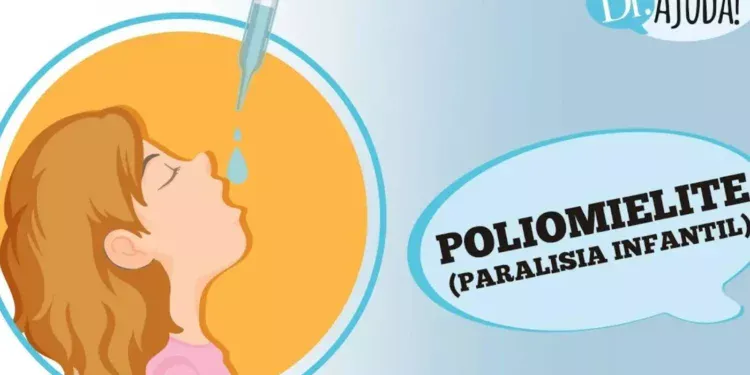 poliomielite:-paralisia-infantil