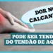 dor-no-calcanhar?-pode-ser-tendinite-do-tendao-de-aqueles