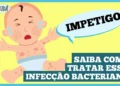 impetigo:-a-infeccao-de-pele-comum-em-criancas!-saiba-como-tratar