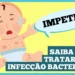impetigo:-a-infeccao-de-pele-comum-em-criancas!-saiba-como-tratar