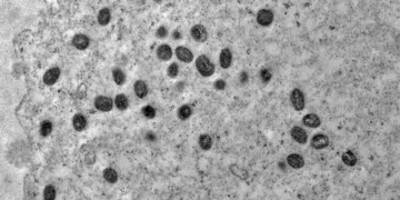 mpox:-sao-paulo-confirma-segundo-caso-da-doenca-pela-nova-cepa-clado-ib